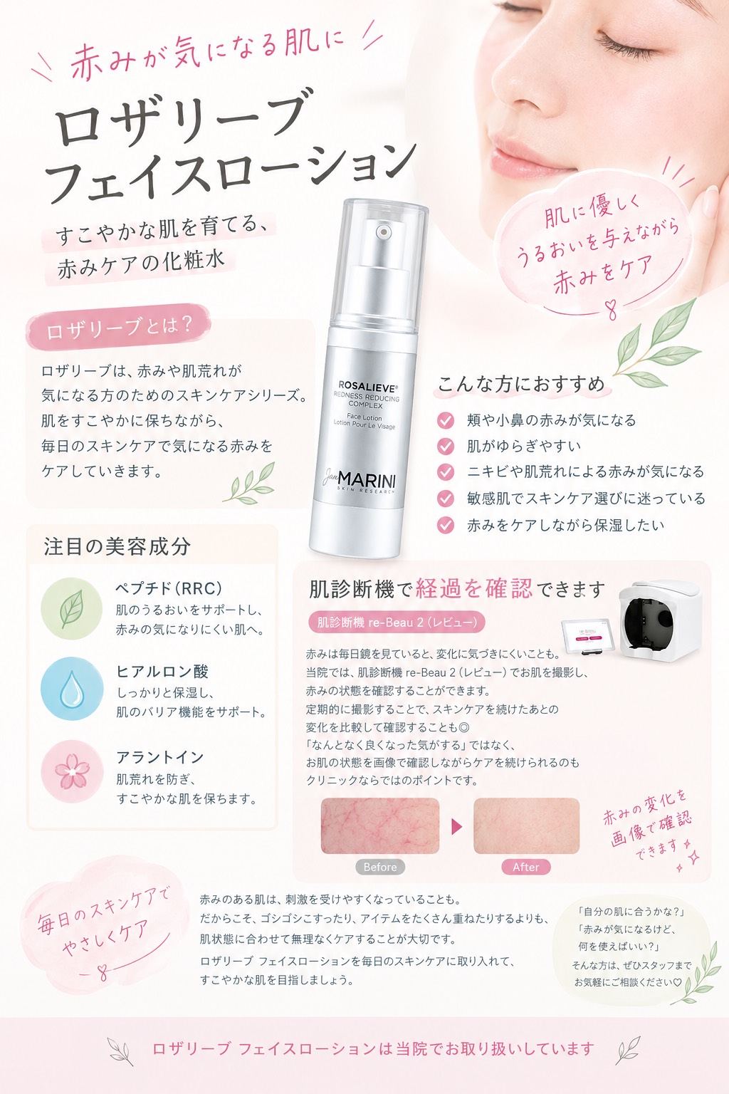 赤みが気になる肌に「ロザリーブ フェイスローション」｜浪速区（なんば）の皮膚科