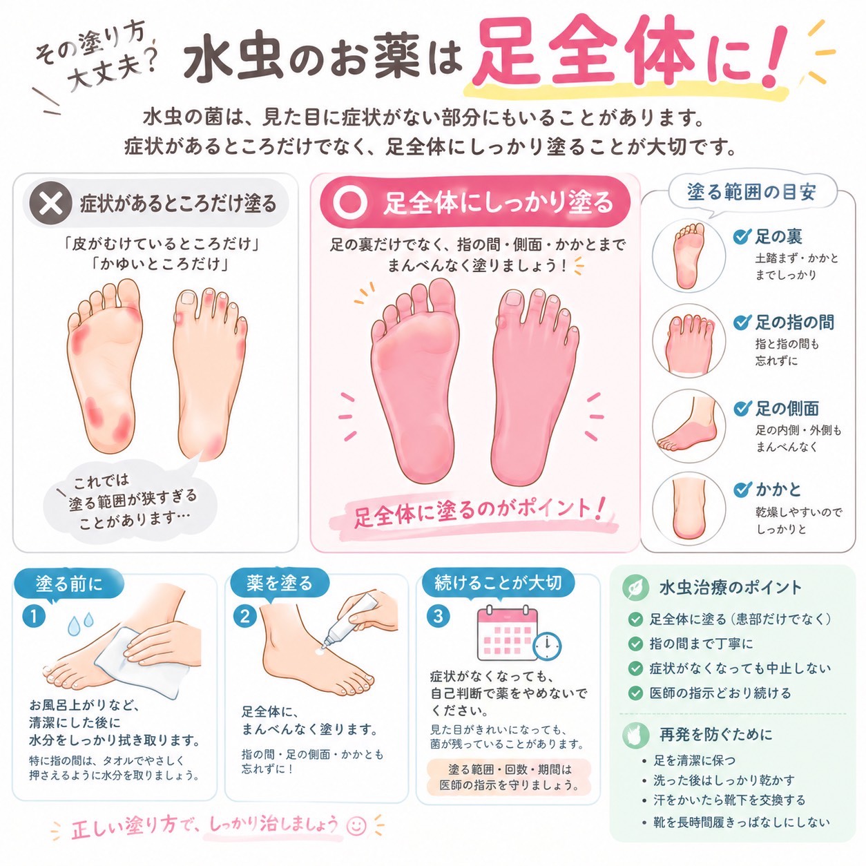 🦶水虫のお薬、正しく塗れていますか？